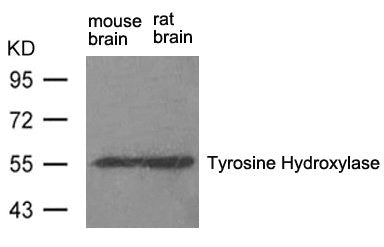Western blot analysis of extract from rat brain and mouse brain using Tyrosine Hydroxylase(Ab-31) Antibody.