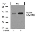 Western blot analysis of extracts from 3T3 cells untreated or treated with serum using Paxillin(Phospho-Tyr118) Antibody.