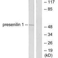 Western blot analysis of extracts from mouse heart cells, using presenilin 1 antibody.