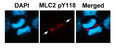Immunofluorescence staining of methanol-fixed U87 cells using MLC2 (Phospho-Tyr118) Antibody.