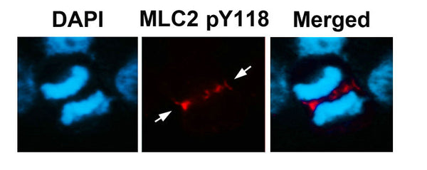 Immunofluorescence staining of methanol-fixed U87 cells using MLC2 (Phospho-Tyr118) Antibody.
