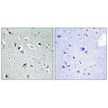 Immunohistochemistry analysis of paraffin-embedded human brain tissue, using CDKA2 antibody.