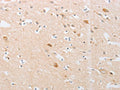The image on the left is immunohistochemistry of paraffin-embedded Human brain tissue using CSB-PA696531(CDKN2AIP Antibody) at dilution 1/20, on the right is treated with fusion protein. (Original magnification: ×200)