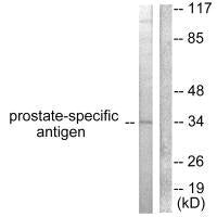 Western blot analysis of extracts from mouse heart, using Prostate-specific Antigen antibody.