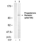 Western blot analysis of extracts from SKOV3 cells untreated(lane 1) or treated with EGF(lane 2) using Progesterone Receptor(Phospho-Ser190) Antibody.