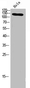 Western blot analysis of hela lysis using ITGA3 antibody. Antibody was diluted at 1:500. Secondary antibody  was diluted at 1:20000