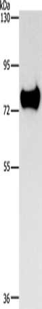 Gel: 8%SDS-PAGE, Lysate: 30 ug, Lane: Mouse brain tissue, Primary antibody: CSB-PA698387(SYN1 Antibody) at dilution 1/900, Secondary antibody: Goat anti rabbit IgG at 1/8000 dilution, Exposure time: 2 seconds