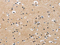 The image is immunohistochemistry of paraffin-embedded Human brain tissue using CSB-PA698913(CKMT2 Antibody) at dilution 1/60. (Original magnification: ×200)