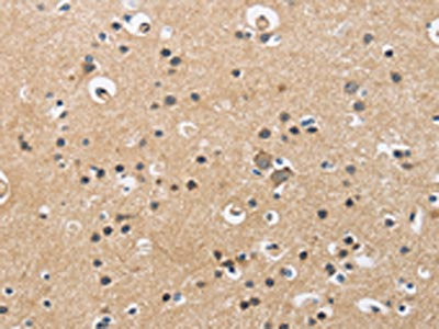 The image is immunohistochemistry of paraffin-embedded Human brain tissue using CSB-PA698913(CKMT2 Antibody) at dilution 1/60. (Original magnification: ×200)