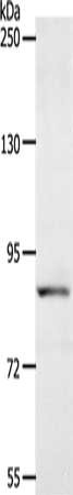 Gel: 8%SDS-PAGE, Lysate: 40 ug, Lane: Human fetal liver tissue, Primary antibody: CSB-PA699520(ACAD11 Antibody) at dilution 1/400, Secondary antibody: Goat anti rabbit IgG at 1/8000 dilution, Exposure time: 1 minute
