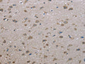 The image on the left is immunohistochemistry of paraffin-embedded Human brain tissue using CSB-PA699536(FAP Antibody) at dilution 1/30, on the right is treated with fusion protein. (Original magnification: ×200)