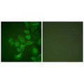 Immunofluorescence analysis of A549 cells, using TIMP2 antibody.