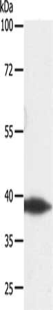 Gel: 10%SDS-PAGE, Lysate: 40 ug, Lane: Human lymphoma tissue, Primary antibody: CSB-PA699630(DTX3 Antibody) at dilution 1/300, Secondary antibody: Goat anti rabbit IgG at 1/8000 dilution, Exposure time: 10 minutes