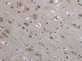The image on the left is immunohistochemistry of paraffin-embedded Human brain tissue using CSB-PA699881(EGFL8 Antibody) at dilution 1/40, on the right is treated with fusion protein. (Original magnification: ×200)
