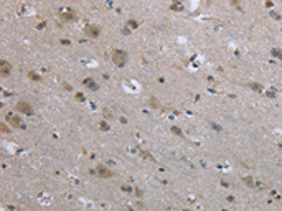 The image on the left is immunohistochemistry of paraffin-embedded Human brain tissue using CSB-PA699881(EGFL8 Antibody) at dilution 1/40, on the right is treated with fusion protein. (Original magnification: ×200)