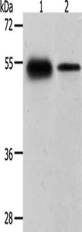 Gel: 10%SDS-PAGE, Lysate: 30 ug, Lane 1-2: Human liver cancer tissue, mouse heart tissue, Primary antibody: CSB-PA700069(CA14 Antibody) at dilution 1/1050, Secondary antibody: Goat anti rabbit IgG at 1/8000 dilution, Exposure time: 20 seconds