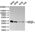 Western Blot
Positive WB detected in: recombinant protein
All lanes:Venom allergen 5  Antibody at 1:1000
Secondary
Goat polyclonal to rabbit IgG at 1/20000 dilution
Predicted band size: 30.2 kDa
Observed band size: 30.2 kDa