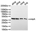 Western Blot
Positive WB detected in: recombinant protein
All lanes:repA Antibody at 1:1000
Secondary
Goat polyclonal to rabbit IgG at 1/20000 dilution
Predicted band size: 39.7 kDa
Observed band size:43 kDa