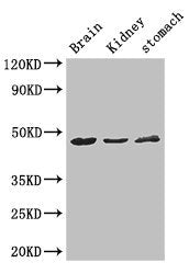 Western Blot
Positive WB detected in: Mouse brain tissue, Mouse kidney tissue, Mouse stomach tissue
All lanes: AGK antibody at 3ug/ml
Secondary
Goat polyclonal to rabbit IgG at 1/50000 dilution
Predicted band size: 48, 8 kDa
Observed band size: 48 kDa