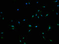 Immunofluorescence staining of U251 cells with CSB-PA708479LA01HU at 1:100, counter-stained with DAPI. The cells were fixed in 4% formaldehyde and blocked in 10% normal Goat Serum. The cells were then incubated with the antibody overnight at 4°C. The secondary antibody was Alexa Fluor 488-congugated AffiniPure Goat Anti-Rabbit IgG(H+L).