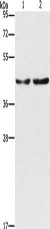 Gel: 10%SDS-PAGE, Lysate: 40 ug, Lane 1-2: Hela cells, 293T cells, Primary antibody: CSB-PA708978(CBX6 Antibody) at dilution 1/600, Secondary antibody: Goat anti rabbit IgG at 1/8000 dilution, Exposure time: 40 seconds