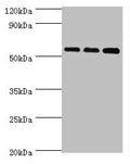 Western blot All lanes: Acyl-coenzyme A synthetase ACSM3, mitochondrial antibody at 10ug/ml Lane 1: 293T whole cell lysate Lane 2: Mouse kidney tissue Lane 3: A431 whole cell lysate Secondary Goat polyclonal to rabbit IgG at 1/10000 dilution Predicted band size: 67, 50 kDa Observed band size: 67 kDa