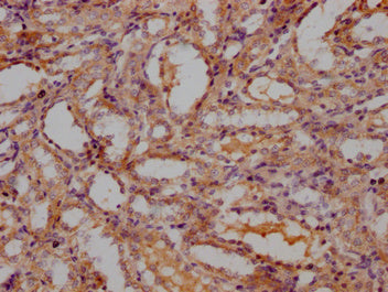 IHC image of CSB-PA714125OA01RA diluted at 1:300 and staining in paraffin-embedded Rat kidney tissue performed on a Leica BondTM system. After dewaxing and hydration, antigen retrieval was mediated by high pressure in a citrate buffer (pH 6.0). Section was blocked with 10% normal goat serum 30min at RT. Then primary antibody (1% BSA) was incubated at 4°C overnight. The primary is detected by a Goat anti-rabbit polymer IgG labeled by HRP and visualized using 0.05% DAB.