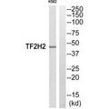 Western blot analysis of extracts from COLO205 cells, using TF2H2 antibody.