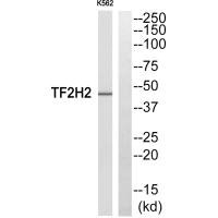 Western blot analysis of extracts from COLO205 cells, using TF2H2 antibody.