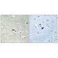 Immunohistochemistry analysis of paraffin-embedded human brain tissue using VEGFR1 antibody.