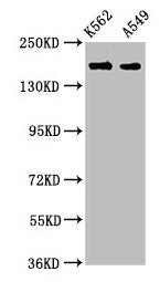 Western Blot
Positive WB detected in: K562 whole cell lysate, A549 whole cell lysate
All lanes: FMN1 antibody at 3.9µg/ml
Secondary
Goat polyclonal to rabbit IgG at 1/50000 dilution
Predicted band size: 158, 72, 54, 133 kDa
Observed band size: 158 kDa