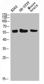 Western Blot analysis of K562 SH-SY5Y mouse-brain cells using E-Selectin Polyclonal Antibody diluted at 1:500. Secondary antibody  was diluted at 1:20000