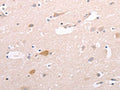 The image on the left is immunohistochemistry of paraffin-embedded Human brain tissue using CSB-PA715372(CIDEB Antibody) at dilution 1/50, on the right is treated with fusion protein. (Original magnification: ×200)