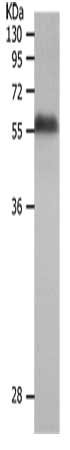 Gel: 10%SDS-PAGE, Lysate: 40 ug, Lane: Human fetal liver tissue, Primary antibody: CSB-PA715440(MMP19 Antibody) at dilution 1/500, Secondary antibody: Goat anti rabbit IgG at 1/8000 dilution, Exposure time: 10 minutes