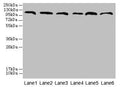 Western blot
All lanes: CATSPERE antibody at 6µg/ml
Lane 1: U87 whole cell lysate
Lane 2: HepG2 whole cell lysate
Lane 3: A549 whole cell lysate
Lane 4: Mouse lung tissue
Lane 5: Mouse liver tissue
Lane 6: PC-3 whole cell lysate
Secondary
Goat polyclonal to rabbit IgG at 1/10000 dilution
Predicted band size: 110, 96, 93 kDa
Observed band size: 110 kDa