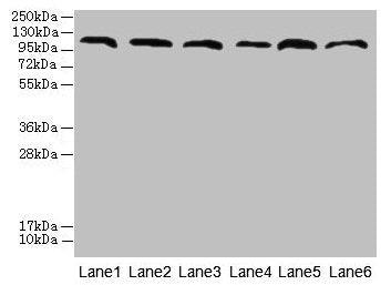Western blot
All lanes: CATSPERE antibody at 6µg/ml
Lane 1: U87 whole cell lysate
Lane 2: HepG2 whole cell lysate
Lane 3: A549 whole cell lysate
Lane 4: Mouse lung tissue
Lane 5: Mouse liver tissue
Lane 6: PC-3 whole cell lysate
Secondary
Goat polyclonal to rabbit IgG at 1/10000 dilution
Predicted band size: 110, 96, 93 kDa
Observed band size: 110 kDa