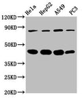 Western Blot
Positive WB detected in: Hela whole cell lysate, HepG2 whole cell lysate, A549 whole cell lysate, PC-3 whole cell lysate
All lanes: PIK3R6 antibody at 3.4µg/ml
Secondary
Goat polyclonal to rabbit IgG at 1/50000 dilution
Predicted band size: 85 kDa
Observed band size: 85 kDa