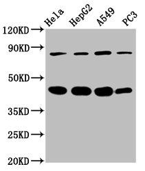 Western Blot
Positive WB detected in: Hela whole cell lysate, HepG2 whole cell lysate, A549 whole cell lysate, PC-3 whole cell lysate
All lanes: PIK3R6 antibody at 3.4µg/ml
Secondary
Goat polyclonal to rabbit IgG at 1/50000 dilution
Predicted band size: 85 kDa
Observed band size: 85 kDa