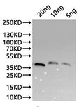 Western Blot
Positive WB detected in: recombinant protein
All lanes:KP509_12G01700 Antibody at 1:1000
Secondary
Goat polyclonal to rabbit IgG at 1/20000 dilution
Predicted band size: 32.1 kDa
Observed band size: 40 kDa