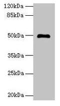Western blot
All lanes: ADAL antibody at 6µg/ml + Mouse kidney tissue
Secondary
Goat polyclonal to rabbit IgG at 1/10000 dilution
Predicted band size: 41, 31, 38 kDa
Observed band size: 50 kDa
