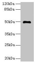 Western blot
All lanes: ADAL antibody at 6µg/ml + Mouse kidney tissue
Secondary
Goat polyclonal to rabbit IgG at 1/10000 dilution
Predicted band size: 41, 31, 38 kDa
Observed band size: 50 kDa