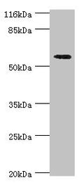 Western blot
All lanes: ACBD5 antibody at 2µg/ml + Hela whole cell lysate
Secondary
Goat polyclonal to rabbit IgG at 1/10000 dilution
Predicted band size: 61, 55, 59, 47 kDa
Observed band size: 61 kDa