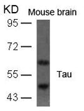 Western blot analysis of extracts from mouse brain tissue using Tau(Ab-396) Antibody.