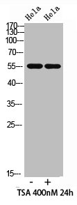 Western blot analysis of hela cells,hela cells, antibody was diluted at 500. Secondary antibody  was diluted at 1:20000
