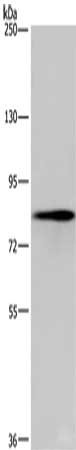 Gel: 6%SDS-PAGE, Lysate: 40 ug, Lane: 293T cells, Primary antibody: CSB-PA730059(EEF2K Antibody) at dilution 1/750, Secondary antibody: Goat anti rabbit IgG at 1/8000 dilution, Exposure time: 10 seconds