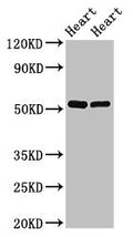 Western Blot
Positive WB detected in: Rat heart tissue, Mouse heart tissue
All lanes: SHE antibody at 2.5ug/ml
Secondary
Goat polyclonal to rabbit IgG at 1/50000 dilution
Predicted band size: 54 kDa
Observed band size: 54 kDa