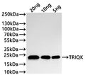 Western Blot
Positive WB detected in: recombinant protein
All lanes:TRIQK Antibody at 1:1000
Secondary
Goat polyclonal to rabbit IgG at 1/20000 dilution
Predicted band size: 18.6 kDa
Observed band size: 23 kDa