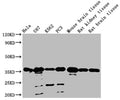 Western Blot Positive WB detected in: Hela whole cell lysate, U87 whole cell lysate, K562 whole cell lysate, PC3 whole cell lysate, Mouse brain tissue, Rat kidney tissue, Rat brain tissue All lanes: METRNL antibody at 1:2000 Secondary Goat polyclonal to rabbit IgG at 1/50000 dilution Predicted band size: 35, 26 KDa Observed band size: 35 KDa Exposure time：1min