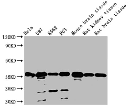 Western Blot Positive WB detected in: Hela whole cell lysate, U87 whole cell lysate, K562 whole cell lysate, PC3 whole cell lysate, Mouse brain tissue, Rat kidney tissue, Rat brain tissue All lanes: METRNL antibody at 1:2000 Secondary Goat polyclonal to rabbit IgG at 1/50000 dilution Predicted band size: 35, 26 KDa Observed band size: 35 KDa Exposure time：1min