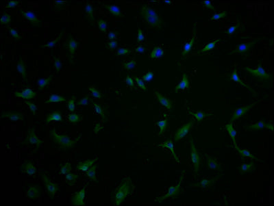 Immunofluorescence staining of U251 cells with CSB-PA732237LA01HU at 1:100, counter-stained with DAPI. The cells were fixed in 4% formaldehyde and blocked in 10% normal Goat Serum. The cells were then incubated with the antibody overnight at 4°C. The secondary antibody was Alexa Fluor 488-congugated AffiniPure Goat Anti-Rabbit IgG(H+L).